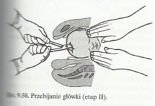 Podręcznik zabijania