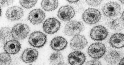 HIV - ukryty zabójca