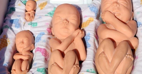Pielęgniarki odmówiły asystowania przy aborcji