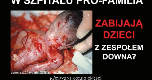 Będzie pikieta pod szpitalem - miejscem aborcji
