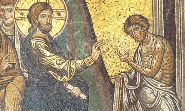 W niedzielę Światowy Dzień Trędowatych