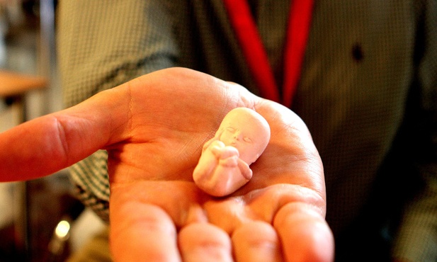 Opinia pielęgniarki wystarczy do aborcji?