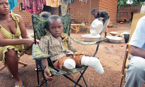  12.02.1014. Republika Środkowej Afryki. Jovachi Mongonou – chłopiec,  który stracił obie nogi podczas walk toczących się w tym kraju od 13 miesięcy. Tysiące osób zginęło, milion uciekło z terenów objętych wojną domową