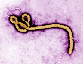 Wirus Ebola spowodował śmierć 932 osób