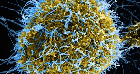 Skuteczna szczepionka na ebolę