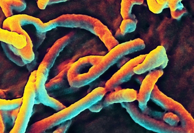 Salezjanie pomagają zarażonym ebolą