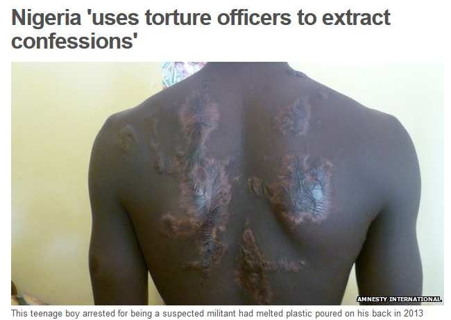 Tortury - rutynowe działania czy przypadki?   