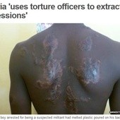 Tortury - rutynowe działania czy przypadki?   