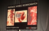 Wystawa pro life "budzi zgorszenie”