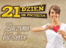 Zorganizuj u siebie wystawę prolife. To łatwe