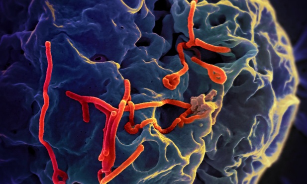 DR Konga: Ponad 740 osób dotkniętych wirusem ebola