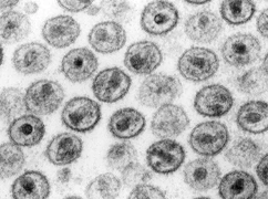 Nowy lek przeciwko HIV trafi do 12 krajów Afryki 