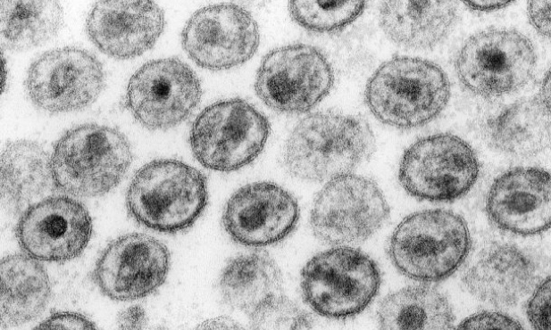 Pierwszy przypadek wyleczenia z HIV?
