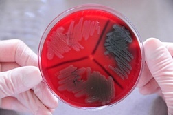Inteligentne bakterie siedzą w… lodówkach
