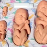 USA: pikiety przed centrami aborcyjnymi Planned Parenthood