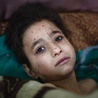  10.03.2016.Damaszek.Syria. Chłopiec ranny po bombardowaniu Dumy, miasta w pobliżu Damaszku. W wyniku bombardowania zginęło  co najmniej sześć osób. Nie wiadomo, kto zaatakował i kto był celem.