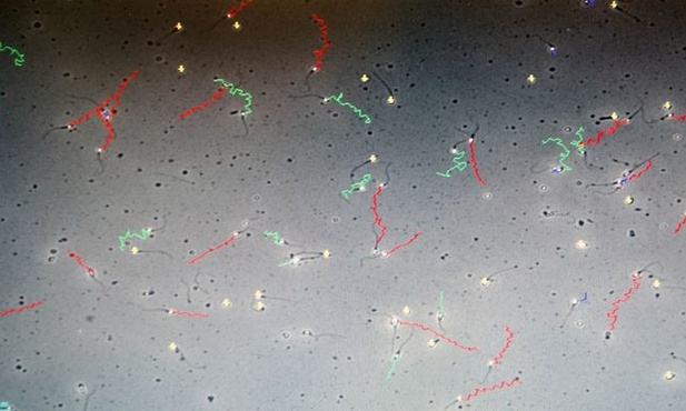 In vitro nie wyklucza naprotechnologii