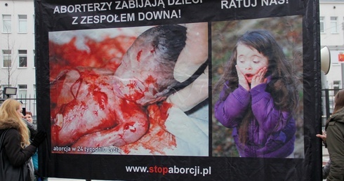Banery szokują, ale tak brutalna jest prawda o aborcji