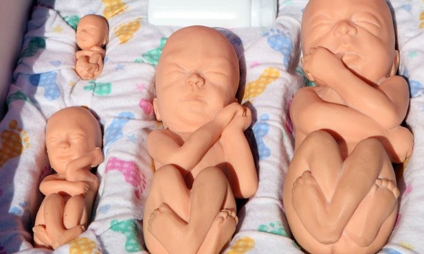 Nie na aborcję, ale wsparcie kobiet