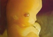 IBRiS: Większość zdecydowanych Polek za całkowitym zakazem aborcji