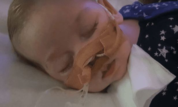 Charlie Gard nie żyje