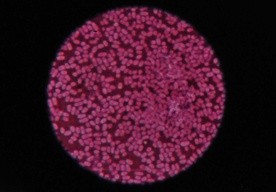 Na UMCS odkryto preparat działający na raka płuc!