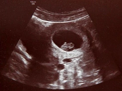 W łonie matki ratują życie