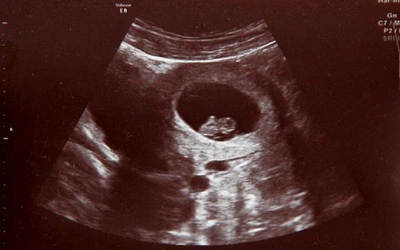 W łonie matki ratują życie