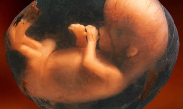 Termin pierwszego czytania projektu "Zatrzymaj aborcję" nie został jeszcze wyznaczony
