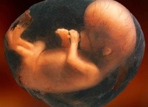 Kolumbia legalizuje aborcję aż do 6 miesiąca ciąży
