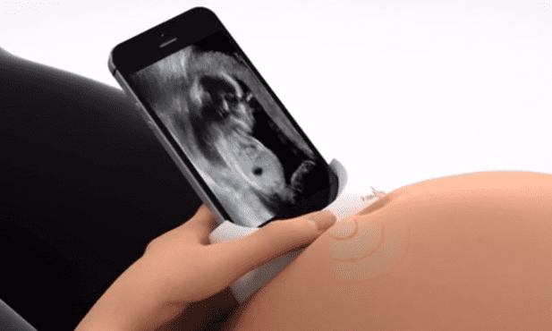 Ciążowe USG przy pomocy smartfona? Czemu nie!