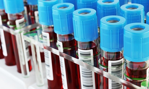 Eksperci: Morfologię krwi powinniśmy wykonywać przynajmniej raz w roku