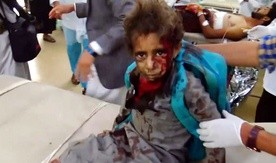 Atak na autobus szkolny pokazuje, że wojna w Jemenie nie rządzi się żadnymi zasadami
