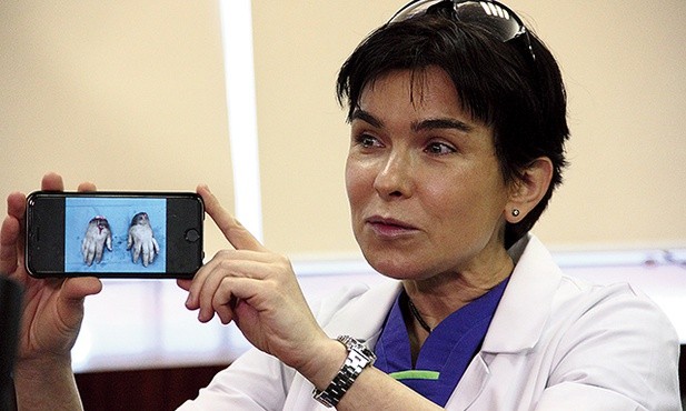 Doc. Anna Chrapusta wyzwań się nie boi. Na zdjęciu podczas konferencji prasowej po replantacji dwóch dłoni odciętych przez gilotynę do cięcia blachy.