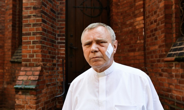 Przewodniczący Episkopatu napisał list do pobitego ks. Aleksandra Ziejewskiego
