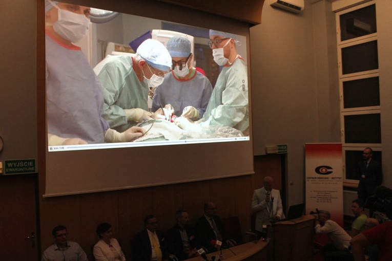 Sukces gliwickich lekarzy  