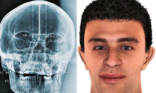 Dziś czaszkę rekonstruuje się, skanując ją za pomocą lasera, który rozpoznaje mnóstwo punktów na jej powierzchni, ale naukowcom udało się właśnie odtworzyć cechy twarzy na podstawie głosu osoby.