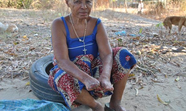 Polska Fundacja dla Afryki prowadzi misję medyczną przeciwko trądowi na Madagaskarze