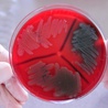 Jak bakterie nas bronią?