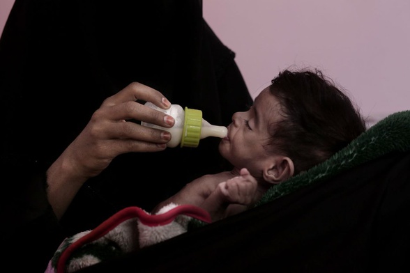 80 proc. Jemeńczyków potrzebuje pomocy humanitarnej