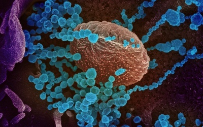 WHO: Nadeszła decydująca chwila w epidemii koronawirusa
