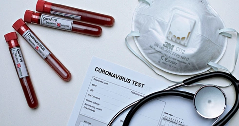 W Polsce przeprowadza się około 4600 testów molekularnych na dobę.