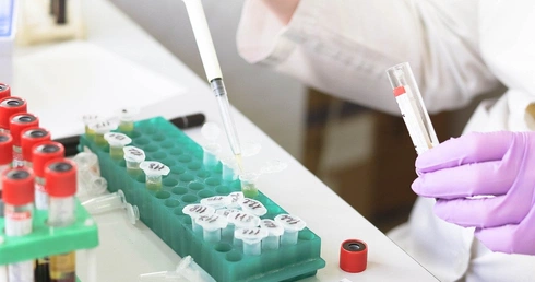 Osocze ozdrowieńców na początek zostanie podane stu chorym Polakom