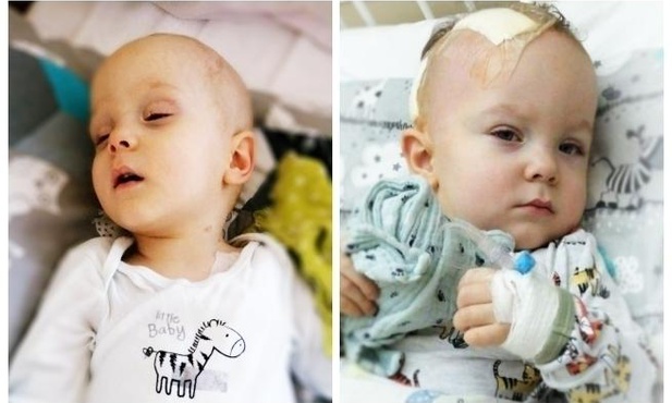 Filip choruje na wyściółczaka anaplastycznego.