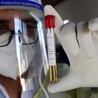 W Hiszpanii w ciągu doby 2031 zakażeń koronawirusem