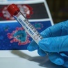 Analizowane są 23 zgony starszych osób po szczepieniach 