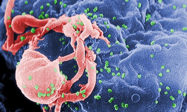 Oxford testuje szczepionkę przeciw HIV