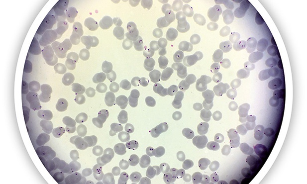 Obraz mikroskopowy pierwotniaka wywołującego malarię, atakującego  czerwone krwinki  człowieka.