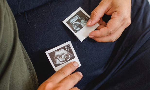 USA: Kościół wzywa do postu i modlitwy w intencji prawnej ochrony życia