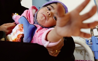 Jemeńskie dziecko cierpiące na niedożywienie otrzymuje wsparcie w szpitalu
13.12.2022  Sana, Jemen